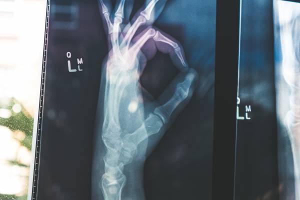 X-ray of hand doing OK sign