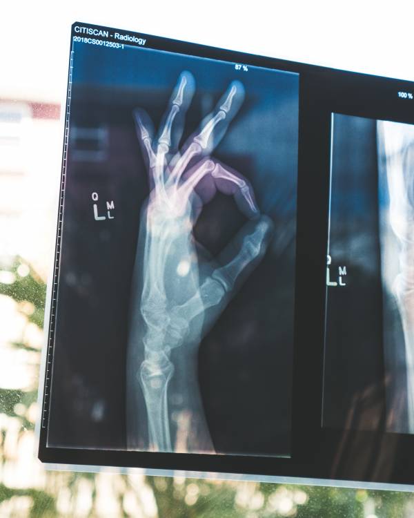 X-ray of hand doing OK sign